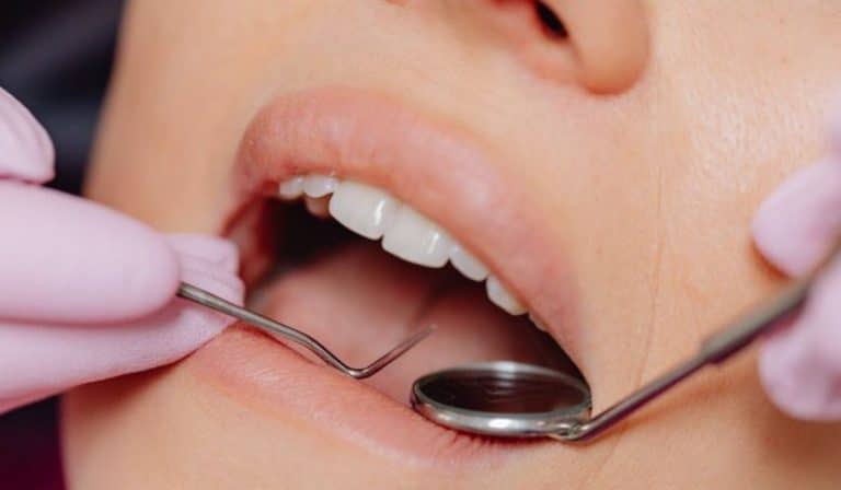 Los abscesos dentales y que los provoca
